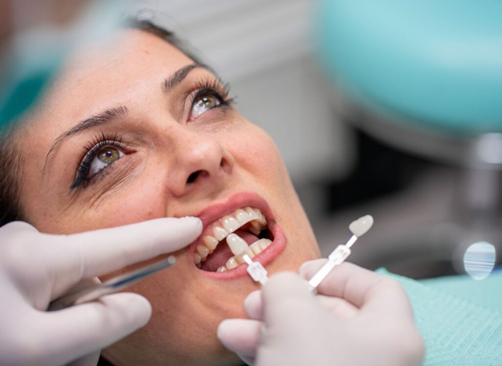 Faccette dentali e sport: ci sono limiti nella vita quotidiana? 1 Faccette dentali e sport