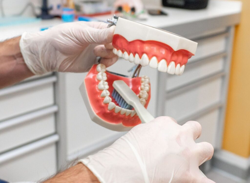 Cibi consigliati dopo la pulizia dei denti